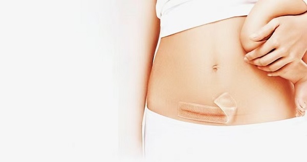 Prečo sú hrubé jazvy zo silikónového gélu také obľúbené?