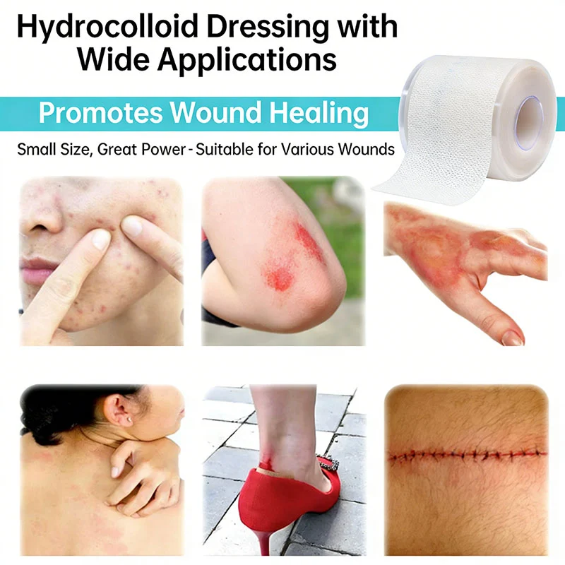 Non Bordered Hydrocolloid Dressing Roll For Traumatic Wounds